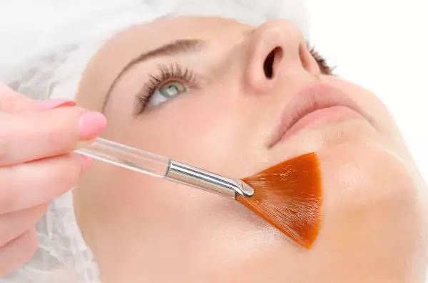 Medical Grade Chemical Peel